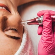 MICRONEEDLING